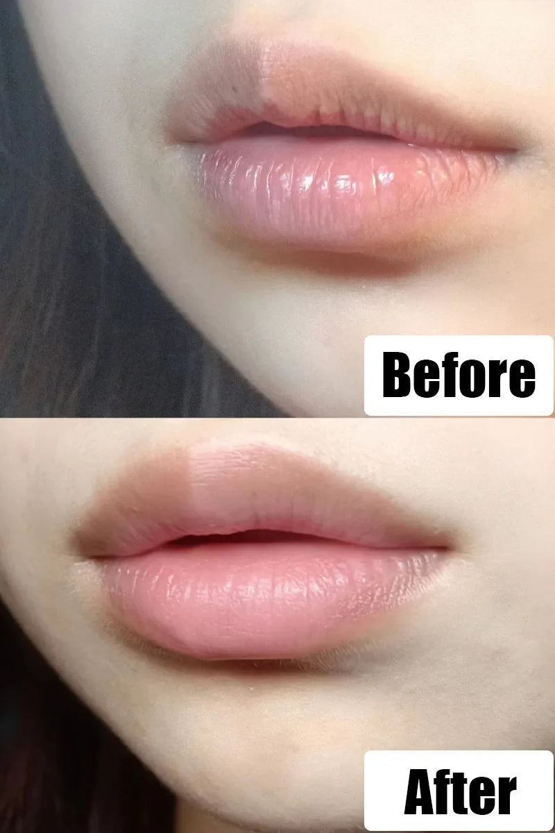 8 Pieces Set Lip Balm Moisturizing Lip Mask Repairing Lips For Men And Women Fade Lip Lines Sleep Labial Membrane Korea Skincare